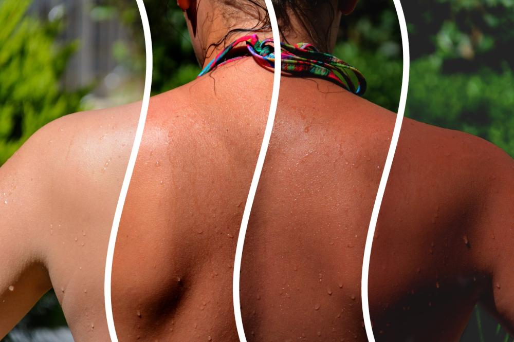 Bronzage